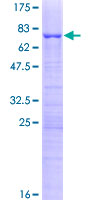 KRR1 Protein - 12.5% SDS-PAGE of human KRR1 stained with Coomassie Blue