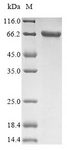 KRT1 / CK1 / Cytokeratin 1 Protein - (Tris-Glycine gel) Discontinuous SDS-PAGE (reduced) with 5% enrichment gel and 15% separation gel.