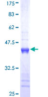 KRT1 / CK1 / Cytokeratin 1 Protein - 12.5% SDS-PAGE Stained with Coomassie Blue.
