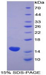 KRT1 / CK1 / Cytokeratin 1 Protein