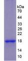 KRT1 / CK1 / Cytokeratin 1 Protein - Recombinant Keratin 1 By SDS-PAGE