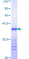 KRT10 / CK10 / Cytokeratin 10 Protein - 12.5% SDS-PAGE Stained with Coomassie Blue.