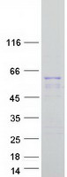 KRT12 / CK12 / Cytokeratin 12 Protein - Purified recombinant protein KRT12 was analyzed by SDS-PAGE gel and Coomassie Blue Staining