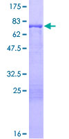 KRT13 / CK13 / Cytokeratin 13 Protein - 12.5% SDS-PAGE of human KRT13 stained with Coomassie Blue