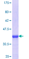 KRT13 / CK13 / Cytokeratin 13 Protein - 12.5% SDS-PAGE Stained with Coomassie Blue.