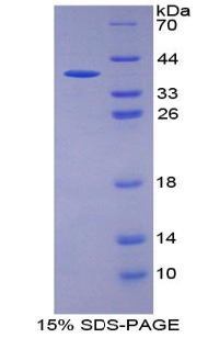 KRT13 / CK13 / Cytokeratin 13 Protein - Recombinant Keratin 13 By SDS-PAGE