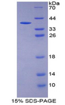 KRT13 / CK13 / Cytokeratin 13 Protein - Recombinant Keratin 13 By SDS-PAGE