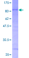 KRT14 / CK14 / Cytokeratin 14 Protein - 12.5% SDS-PAGE of human KRT14 stained with Coomassie Blue