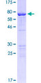 KRT15 / CK15 / Cytokeratin 15 Protein - 12.5% SDS-PAGE of human KRT15 stained with Coomassie Blue