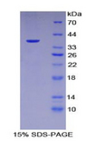 KRT15 / CK15 / Cytokeratin 15 Protein - Recombinant Keratin 15 By SDS-PAGE