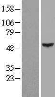 KRT16 / CK16 / Cytokeratin 16 Protein - Western validation with an anti-DDK antibody * L: Control HEK293 lysate R: Over-expression lysate