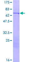 KRT16 / CK16 / Cytokeratin 16 Protein - 12.5% SDS-PAGE of human KRT16 stained with Coomassie Blue