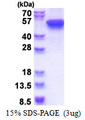 KRT16 / CK16 / Cytokeratin 16 Protein