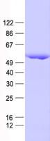 KRT16 / CK16 / Cytokeratin 16 Protein