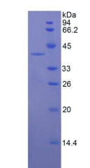 KRT16 / CK16 / Cytokeratin 16 Protein - Recombinant Keratin 16 By SDS-PAGE