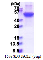 KRT17 / CK17 / Cytokeratin 17 Protein