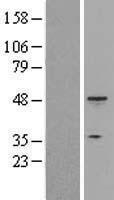 KRT18 / CK18 / Cytokeratin 18 Protein - Western validation with an anti-DDK antibody * L: Control HEK293 lysate R: Over-expression lysate