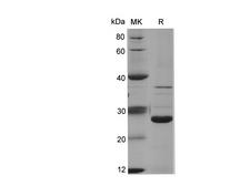 KRT18 / CK18 / Cytokeratin 18 Protein - Recombinant Human KRT18 Protein (His Tag)-Elabscience