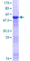 KRT18P55  Protein