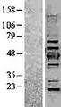 KRT19 / CK19 / Cytokeratin 19 Protein - Western validation with an anti-DDK antibody * L: Control HEK293 lysate R: Over-expression lysate