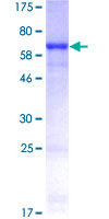 KRT19 / CK19 / Cytokeratin 19 Protein - 12.5% SDS-PAGE of human KRT19 stained with Coomassie Blue
