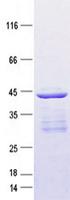 KRT19 / CK19 / Cytokeratin 19 Protein