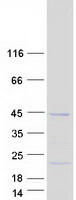 KRT19 / CK19 / Cytokeratin 19 Protein - Purified recombinant protein KRT19 was analyzed by SDS-PAGE gel and Coomassie Blue Staining