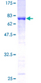 KRT20 / CK20 / Cytokeratin 20 Protein - 12.5% SDS-PAGE of human KRT20 stained with Coomassie Blue