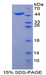 KRT20 / CK20 / Cytokeratin 20 Protein - Recombinant  Keratin 20 By SDS-PAGE