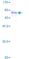 KRT23 / Keratin 23 Protein - 12.5% SDS-PAGE of human KRT23 stained with Coomassie Blue