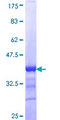 KRT24 / Keratin 24 Protein - 12.5% SDS-PAGE Stained with Coomassie Blue.