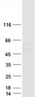 KRT24 / Keratin 24 Protein - Purified recombinant protein KRT24 was analyzed by SDS-PAGE gel and Coomassie Blue Staining
