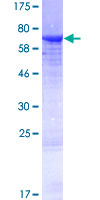 KRT25 / Keratin 25 Protein - 12.5% SDS-PAGE of human KRT25 stained with Coomassie Blue