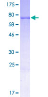KRT28 / Keratin 28 Protein - 12.5% SDS-PAGE of human KRT28 stained with Coomassie Blue