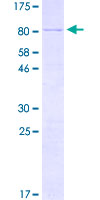 KRT3 / CK3 / Cytokeratin 3 Protein - 12.5% SDS-PAGE of human KRT3 stained with Coomassie Blue