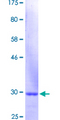 KRT3 / CK3 / Cytokeratin 3 Protein - 12.5% SDS-PAGE Stained with Coomassie Blue.