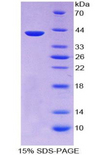 KRT3 / CK3 / Cytokeratin 3 Protein - Recombinant Keratin 3 By SDS-PAGE