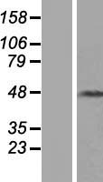 KRT31 / Keratin 31 / KRTHA1 Protein - Western validation with an anti-DDK antibody * L: Control HEK293 lysate R: Over-expression lysate