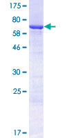 KRT32 / Keratin 32 / KRTHA2 Protein - 12.5% SDS-PAGE of human KRT32 stained with Coomassie Blue