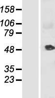 KRT34 / Keratin 34 / KRTHA4 Protein - Western validation with an anti-DDK antibody * L: Control HEK293 lysate R: Over-expression lysate