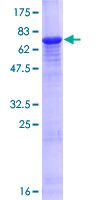 KRT34 / Keratin 34 / KRTHA4 Protein - 12.5% SDS-PAGE of human KRT34 stained with Coomassie Blue
