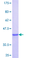KRT34 / Keratin 34 / KRTHA4 Protein - 12.5% SDS-PAGE Stained with Coomassie Blue.