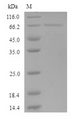 KRT35 / Keratin 35 / KRTHA5 Protein - (Tris-Glycine gel) Discontinuous SDS-PAGE (reduced) with 5% enrichment gel and 15% separation gel.