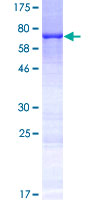 KRT35 / Keratin 35 / KRTHA5 Protein - 12.5% SDS-PAGE of human KRT35 stained with Coomassie Blue