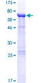 KRT36 / Keratin 36 / KRTHA6 Protein - 12.5% SDS-PAGE of human KRT36 stained with Coomassie Blue