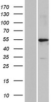 KRT39 / Cytokeratin 39 Protein - Western validation with an anti-DDK antibody * L: Control HEK293 lysate R: Over-expression lysate