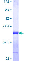 KRT4 / CK4 / Cytokeratin 4 Protein - 12.5% SDS-PAGE Stained with Coomassie Blue.