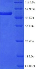 KRT4 / CK4 / Cytokeratin 4 Protein