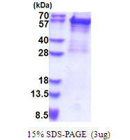 KRT5 / CK5 / Cytokeratin 5 Protein