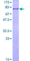 KRT6A / CK6A / Cytokeratin 6A Protein - 12.5% SDS-PAGE of human KRT6A stained with Coomassie Blue